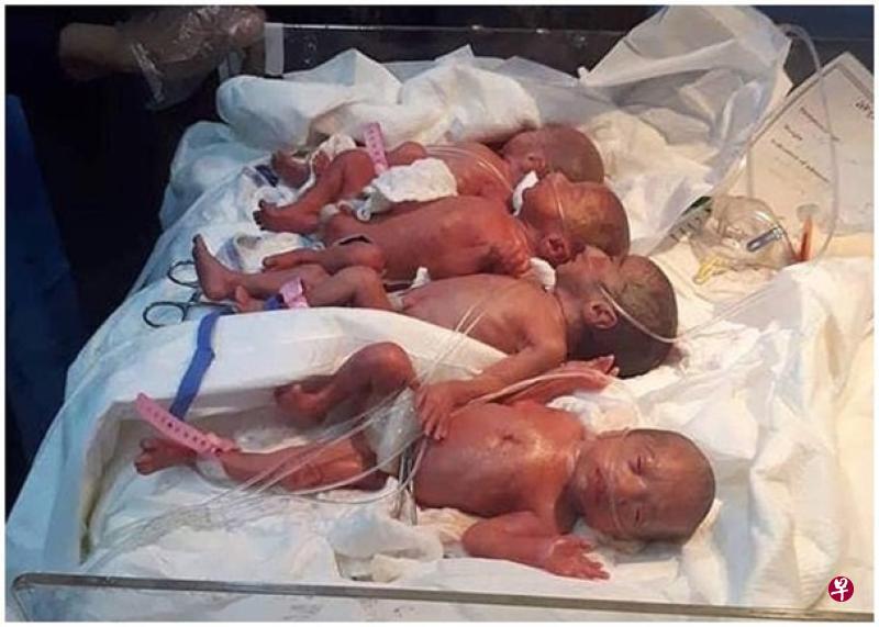 伊拉克一女子顺产七胞胎 系该国首例:国外一女子生17胞胎