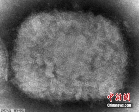 世卫：猴痘病毒已发生人际传播 未来或发现更多病例 (http://www.jianqigroup.com/) 国际 第1张