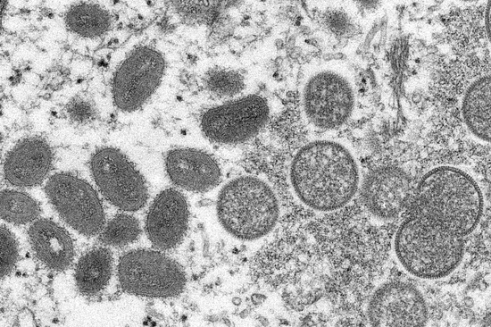 电子显微镜图像显示的成熟猴痘病毒（左）和未成熟病毒粒子（右）。（资料图）