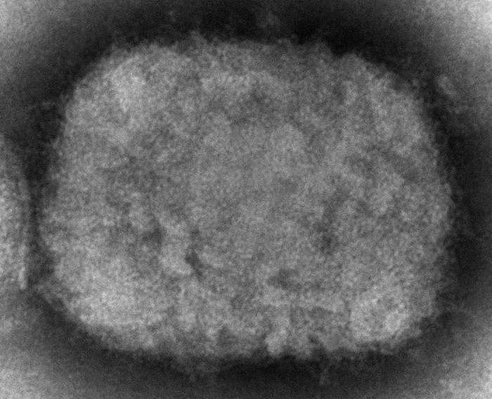 ↑电子显微镜图像显示猴痘病毒。